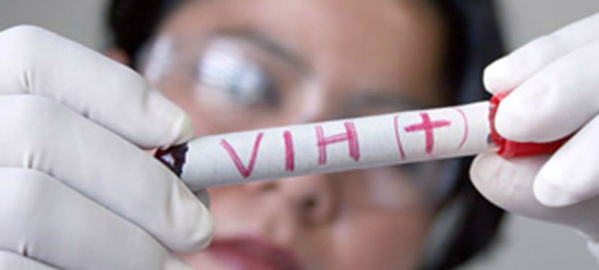 Diseñan un chip que detecta el VIH en la primera semana de infección