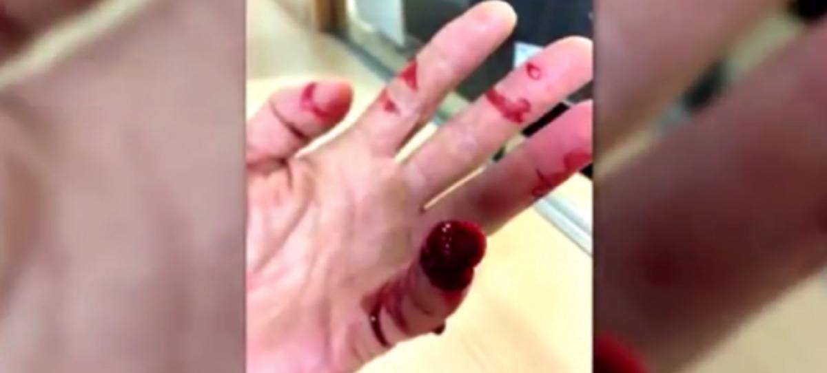 Un marroquí muerde y arranca el dedo a un policía de Getafe