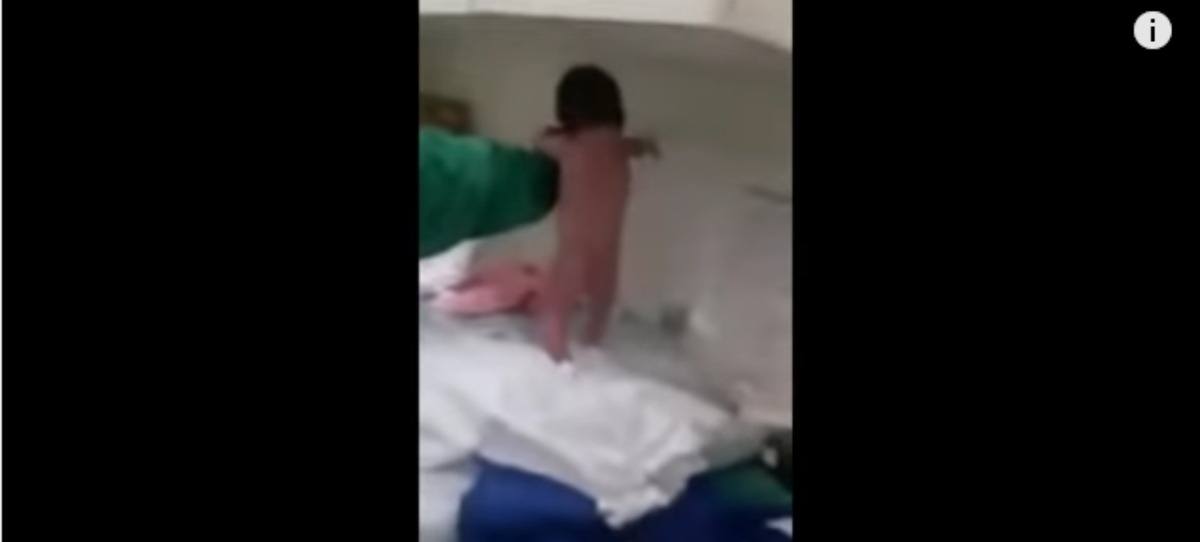 Un bebé recién nacido ‘camina’ sobre la mesa del hospital