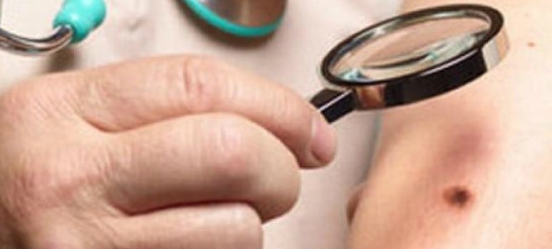 La agencia sanitaria francesa pide el cierre de las cabinas de bronceado por el riesgo de cáncer de piel