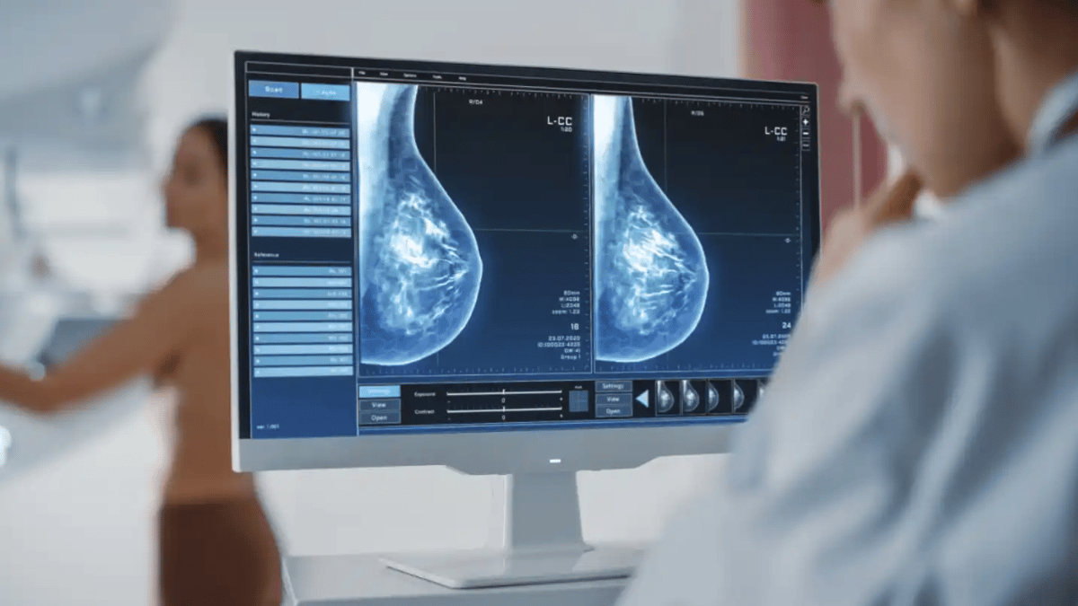 <strong></noscript>Transmural Biotech completa la validación europea de quantusMM, un test basado en IA para el diagnóstico del cáncer de mama</strong>
